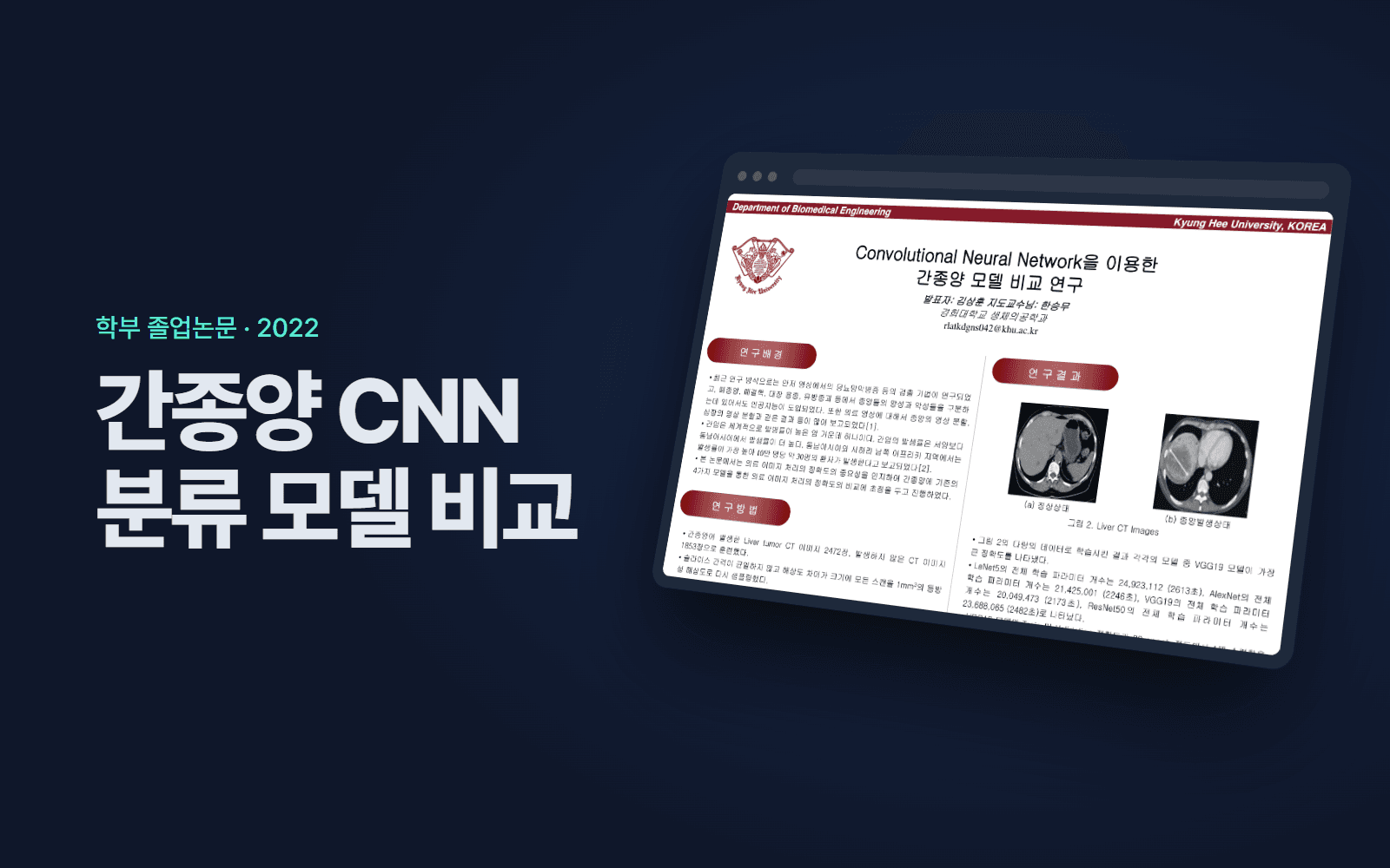 간종양 CNN 분류 모델 비교 화면 목업